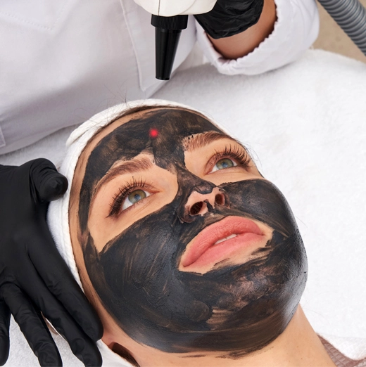 peeling hollywood con carbón activo